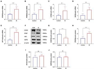 2-Deoxyglucose alleviates migraine-related behaviors by modulating microglial inflammatory factors in experimental model of migraine